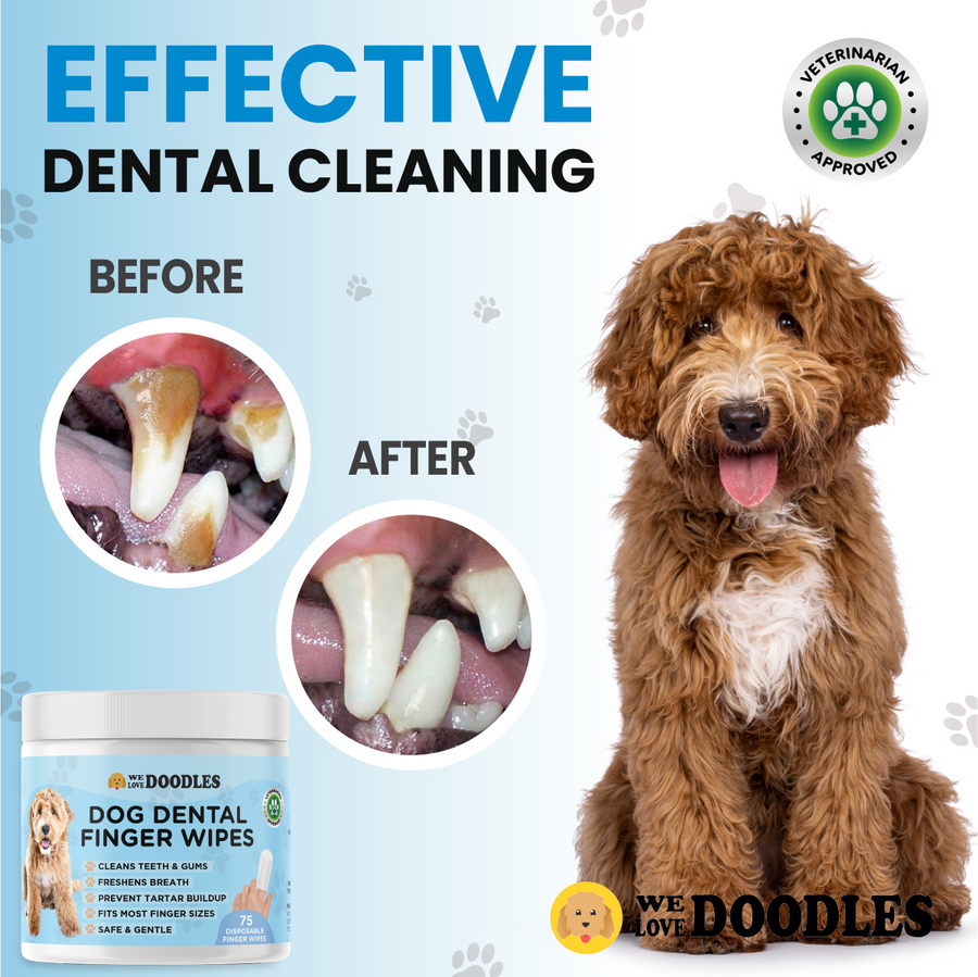 Dog Dental Finger Wipes (75 PCS)